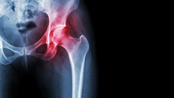 moderne metode liječenja artroze koljena